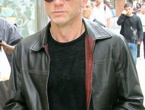 Daniel Craig plastic surgery (27)