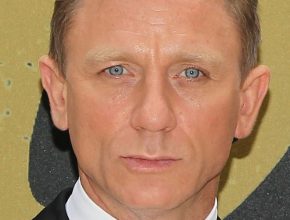 Daniel Craig plastic surgery (29)