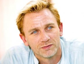 Daniel Craig plastic surgery (33)