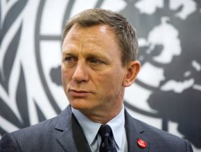 Daniel Craig plastic surgery (36)