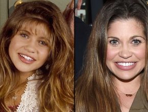 Danielle Fishel before and after plastic surgery