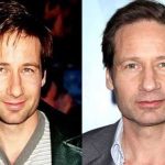 David Duchovny before and after plastic surgery (15)