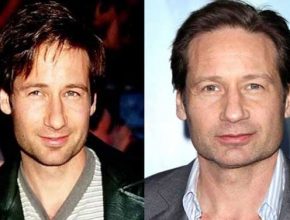 David Duchovny before and after plastic surgery (15)