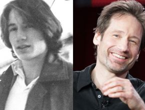 David Duchovny before and after plastic surgery