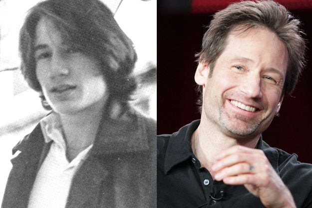 David Duchovny before and after plastic surgery