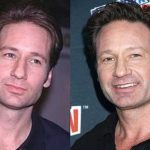 David Duchovny plastic surgery (16)