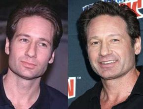 David Duchovny plastic surgery (16)