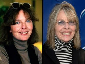 Diane Keaton before an after plastic surgery (01)