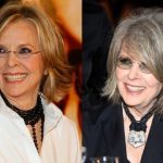 Diane Keaton before an after plastic surgery (10)