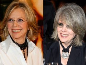 Diane Keaton before an after plastic surgery (10)