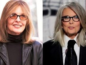 Diane Keaton before an after plastic surgery (11)