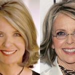 Diane Keaton before an after plastic surgery (7)