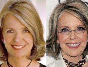 Diane Keaton before an after plastic surgery (7)