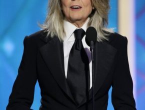 Diane Keaton plastic surgery (1)