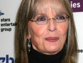 Diane Keaton plastic surgery (34)