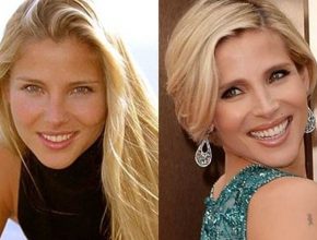 Elsa Pataky before and after plastic surgery (14)