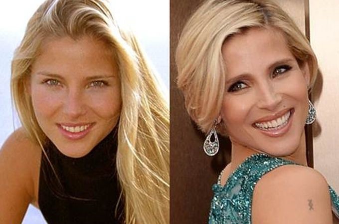 Elsa Pataky Before And After Plastic Surgery 14 Celebrity Plastic Elsa Pataky Before And After Plastic Surgery 14 Celebrity Plastic