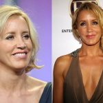 Felicity Huffman before and after plastic surgery (11)