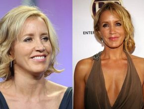 Felicity Huffman before and after plastic surgery (11)