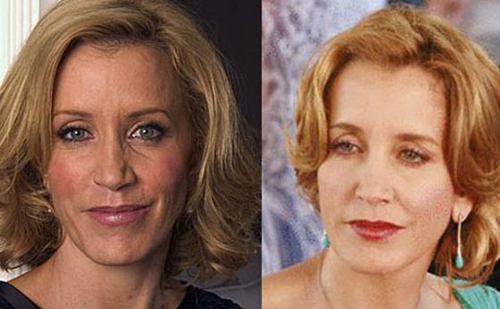 Felicity Huffman before and after plastic surgery
