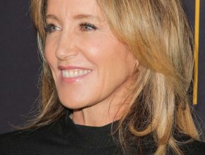 Felicity Huffman plastic surgery (6)
