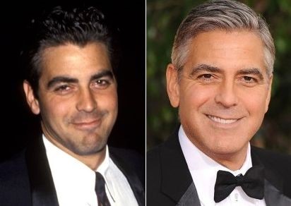 George Clooney before and after plastic surgery