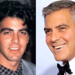 George Clooney before and after plastic surgery (21)
