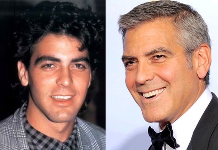 George Clooney before and after plastic surgery (21) – Celebrity ...