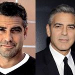 George Clooney before and after plastic surgery (22)