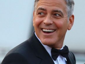 George Clooney plastic surgery (1)