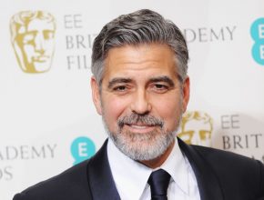 George Clooney plastic surgery (14)