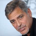George Clooney plastic surgery (2)