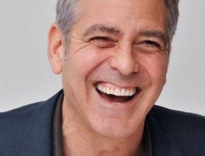 George Clooney plastic surgery (5)