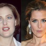 Gillian Anderson before and after plastic surgery (12)