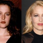 Gillian Anderson before and after plastic surgery (15)