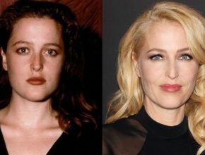 Gillian Anderson before and after plastic surgery (15)