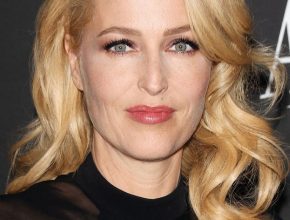 Gillian Anderson plastic surgery (01)