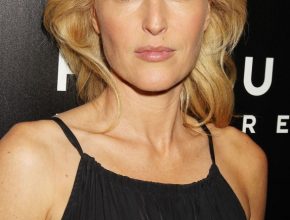 Gillian Anderson plastic surgery (10)