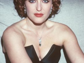 Gillian Anderson plastic surgery (17)