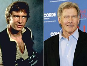 Harrison Ford before and after plastic surgery