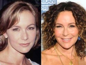 Jennifer Grey before and after plastic surgery (25)