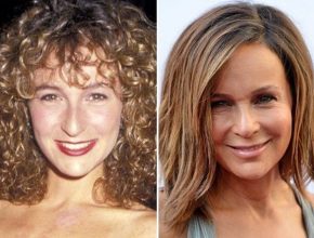 Jennifer Grey before and after plastic surgery