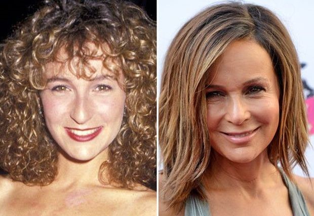 Jennifer Grey before and after plastic surgery