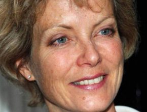 Jenny Seagrove plastic surgery