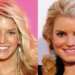 Jessica Simpson before and after plastic surgery (20)