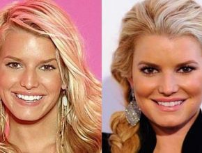 Jessica Simpson before and after plastic surgery (20)