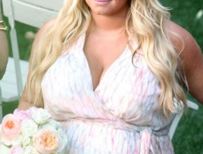 Jessica Simpson plastic surgery (10)