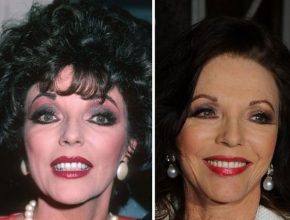 Joan Collins before and after plastic surgery (40)