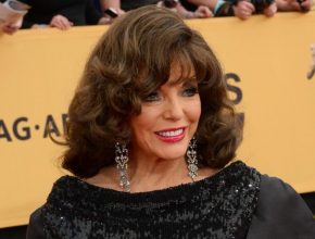 Joan Collins plastic surgery (10)