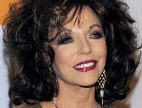 Joan Collins plastic surgery (11)